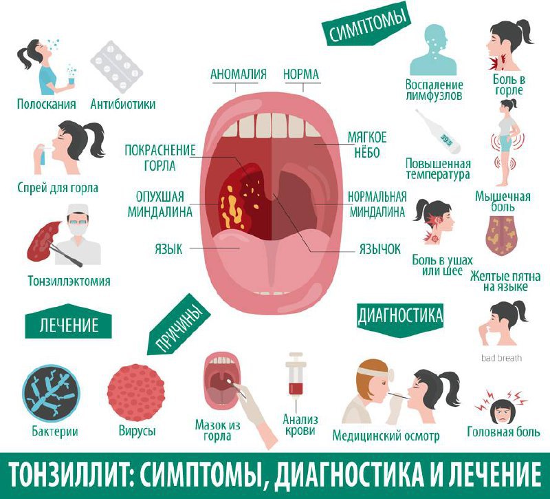 Температура, боль в горле и сыпь - причины, признаки, обследования и лечения