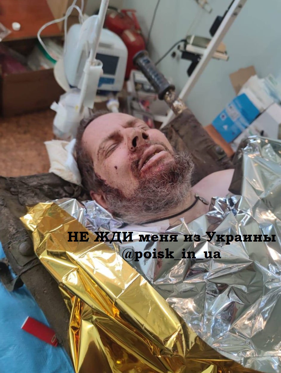 Треш война украина телеграмм фото 113